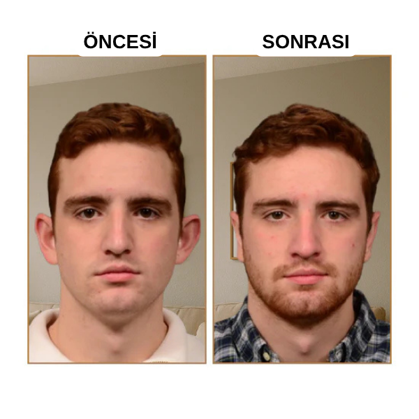 EARLAST™ Kulak Bandı (20 Adet 5-6 Ay Kullanım İçin Uygun)