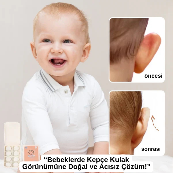 EARLAST™ Kulak Bandı (20 Adet 5-6 Ay Kullanım İçin Uygun)