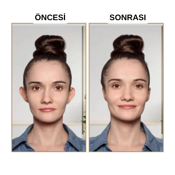 EARLAST™ Kulak Bandı (20 Adet 5-6 Ay Kullanım İçin Uygun)