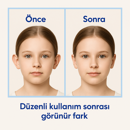 EARLAST™ Kulak Bandı (20 Adet 5-6 Ay Kullanım İçin Uygun)